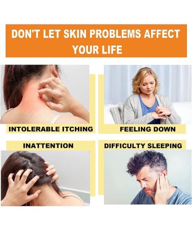 HEKEWER Youth Bee Venom Psoriasis Treatment Cream - Soothing Moisturizing Formula for All Skin Types - Buy Online on GoSupps.com