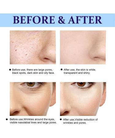 Face Serum - Moisturiser Face Women - Hydrating Serum with Vitamin E - Replenishing Essence Repair Damaged Skin - Improving Reduce Fade Spot Remove Dark Circle - Skincare Rejuvenate Anti-wrinkle Oil - Buy Online on GoSupps.com