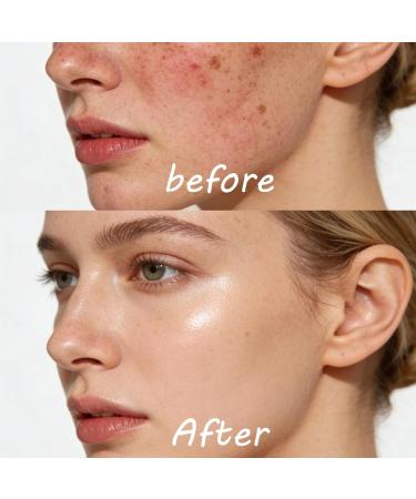 CLY AMS Face Moisturizer Cream with Hyaluronic Acid Hydrating & Barrier Repair Moisturizing Cream Lightweight Daily Face Cream to Soothe Smooth & Nourish Skin For All Skin Types (1.76 Oz) - Buy Online on GoSupps.com