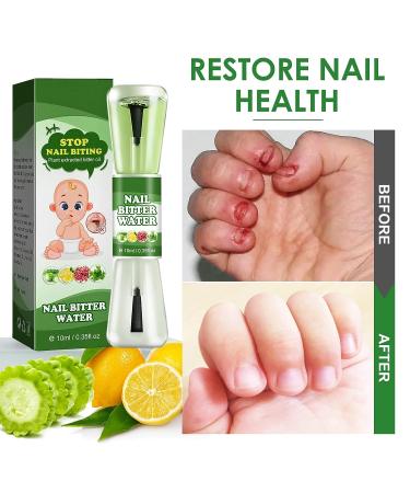 Bitter Nail Biting Treatment for Kids & Adults - Stop Thumb Sucking with Safe Natural Plant Extract - Nail Care Solution - Buy Online on GoSupps.com