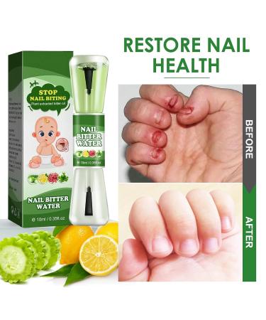 Nail Biting & Thumb Sucking Treatment for Kids - Bitter-Taste Plant Extract - 0.35 Fl Oz - Buy Online on GoSupps.com