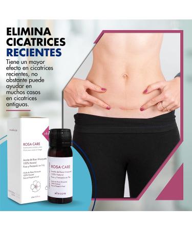 FMITA Pack Cicatrices reduction plaster with hyaluronic acid + 100 natural rose ideal for scars and queloids caesareans aesthetic operations burns - Buy Online on GoSupps.com