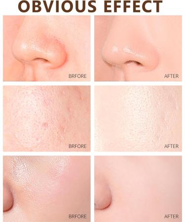 Peel Off Face Masks Blackhead Remover Gold Face Masks Skincare Pore Strips Deep Clean Purify Pore Reduce Acne Anti Aging Even Out Skin Tone Women And Mens Skin Care-120g - Buy Online on GoSupps.com