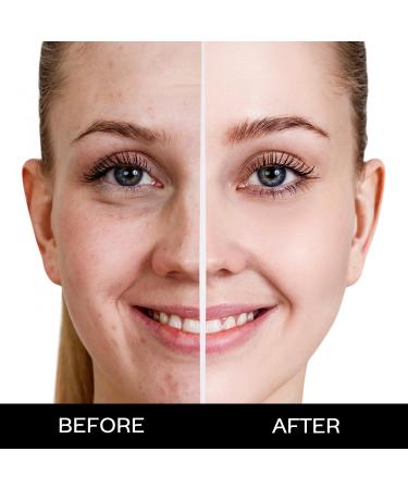 Weightless Matte Finish Foundation - Beige 15ml | Lightweight | Natural Finish | Anti-Ageing | Non-Clog Pores | Enriched With Olive Seed Oil Grape Extract Shea Butter - Buy Online on GoSupps.com