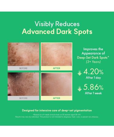 Easydew DW-EGF Melatoning Ampoule 5X - Hydrating Dark Spot Serum with Niacinamide & Glutathione for Uneven Skin - Fast Absorbing Day & Night Ampoule Korean Skin Care (Pump 0.27 fl oz EGF 5X) - Buy Online on GoSupps.com