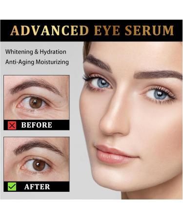 Time Eraser Rollerball with 100% Organic Castor Oil & Frankincense - Anti-Wrinkle Serum for Eyes Reduces Fine Lines (2 PCS) - International Shipping - Buy Online on GoSupps.com