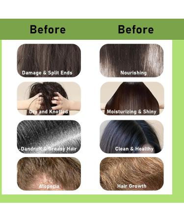 Tea Tree Shampoo Bar Rosemary Tea Tree Oil Bar for Hair Growth Cleanse Moisturize Nourish Natural Shampoo Bar for Itchy & Dry Scalp Suitable for All Hair Types 60g/2.1oz - Buy Online on GoSupps.com