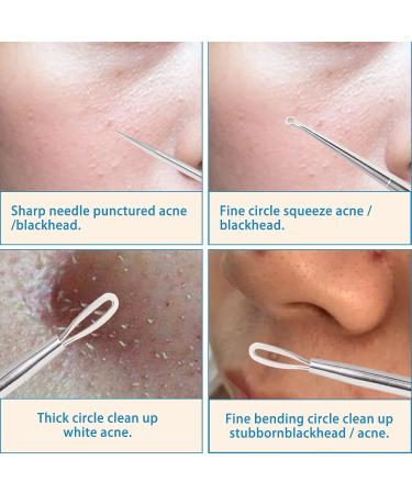 Professional Blackhead and Whitehead Extractor Tool Kit - 5 Pcs/Set for Face and Nose - Stainless Steel Pimple Popper Set VT921A - Buy Online on GoSupps.com