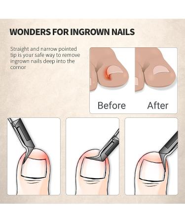 Feryes Stainless Steel Nail Tongs - Sharp Tip Ingrown Toenail & Thick Nail Scissors - Professional Podology Tool with Wide Jaw - Buy Online on GoSupps.com