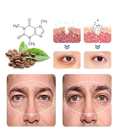 Klarime Open Eyes Awaken Peptide Lifting Eye Gel - Reduces Puffiness, Dark Circles, Under Eye Bags, and Wrinkles - 1pcs - Buy Online on GoSupps.com