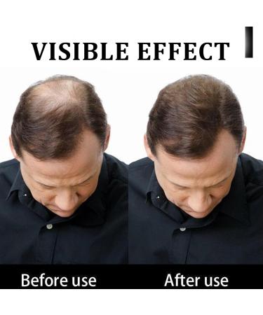 Hair Building Fibers Natural Hair Fibers for Men & Women Hair Fibres Dark Brown Hair Powder for Thinning Hair Easily Cover & Waterproof Hair Loss Concealer Instantly Conceals Hair Loss Soft Powder - Buy Online on GoSupps.com