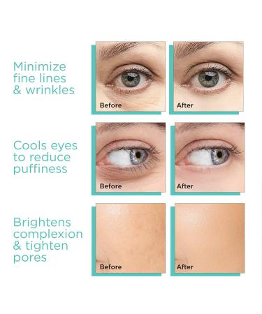 Monأ©tBeauty Ice Globes - Freezer Safe Facial Tools for Skin Tightening, Puffiness Reduction & Enhanced Circulation (Blue) - Buy Online on GoSupps.com