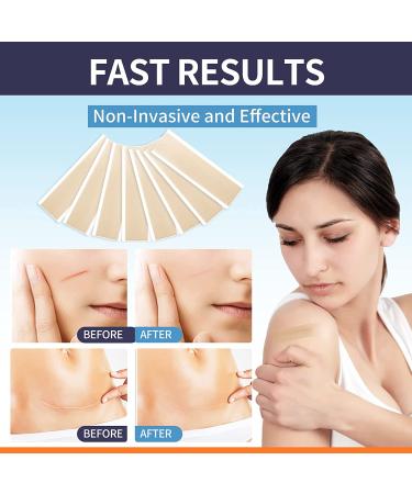 Silicone Scar Sheets 8 Pack - Scar Away Strips for Scars, Keloid, C-Section, Surgical - Reusable Scar Removal Gel Tape - 16 Week Supply - Tummy Tuck Post Surgery Supplies (5.9 x 1.57) - Buy Online on GoSupps.com