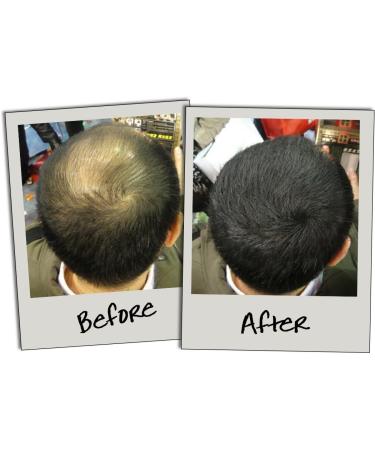 3D Hair Fibres Medium Brown 10g | Natural Hair Thickening Solution for Fuller Locks - Buy Online on GoSupps.com