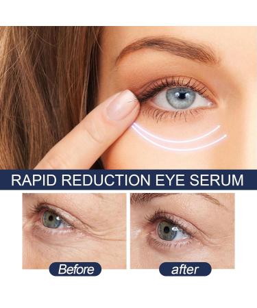 Rapid Reduction Eye Serum  Advanced Formula Anti Aging Serum Visibly Reduces Under-Eye Bags - Buy Online on GoSupps.com