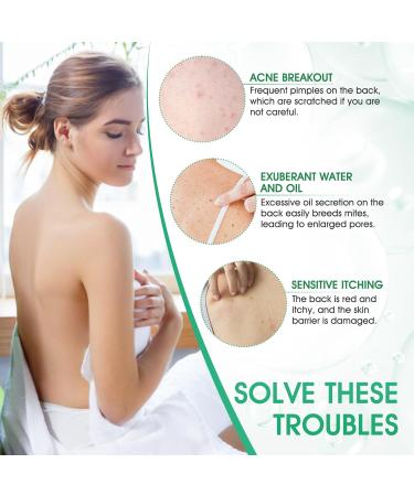  Miioto Back Acne Treatment Spray Back Acne and Chest Acne Removes Excess Oil on the Body and Penetrates Pores Soft and Non-Irritating 120ml - Buy Online on GoSupps.com