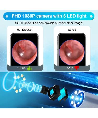 1080P WiFi Ear Cleaner Camera with 8 Pcs Ear Set - Blue | Ear Wax Removal Tool with Light | Waterproof Ear Wax Remover Compatible with iPhone and Android - Buy Online on GoSupps.com