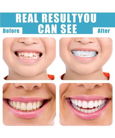 Buy WTTFC 2 Pair Veneer Prostheses - Fake Teeth for a Perfect Smile | Upper & Lower Cosmetic Dentures for Men & Women - Tooth Whitening Solutions - Buy Online on GoSupps.com