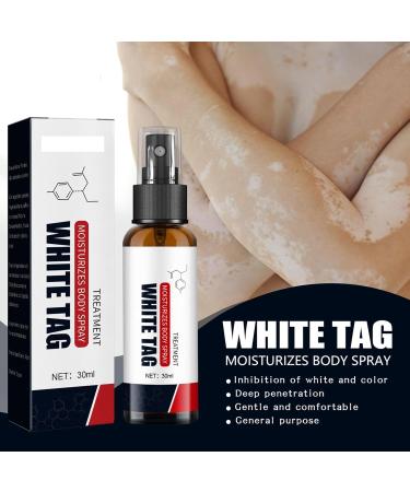 KOAHDE Psoriasis Treatment Spray Vitiligo Relief Spray Psoriasis Control Face and Body Cream Soothing and Moisturizing Coal Tar Psoriasis Cream Spray Psoriasis Control White Spot Spray 30ml 1PC - Buy Online on GoSupps.com