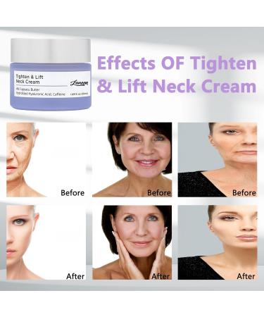 New Firming Neck Cream - Tightening Lifting & Moisturizing | Smooths Repairs Evens Skin Tone Reduces Wrinkles - 1.7 oz - Buy Online on GoSupps.com