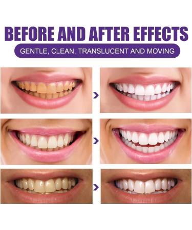 Purple Teeth Whitening Powder - V34 Purple Corrector & Stain Remover for Coffee Smoking & Tea (2PCs) | Effective Teeth Whitening Solution - Buy Online on GoSupps.com