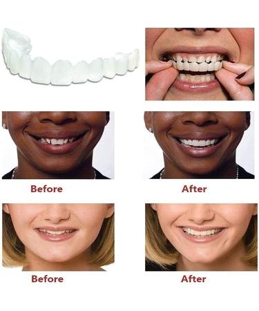 XLBHSH Cosmetic Dentures - 2 Pairs of Temporary Teeth Veneers for Comfort Fit | Upper & Lower False Teeth - Buy Online on GoSupps.com