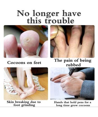 Cuttable Toe Tube Sleeves 5 Pack - Elastic Fabric & Silicone Gel Protectors for Bunion Hammer Toe Callus Blister - International Shipping - Buy Online on GoSupps.com