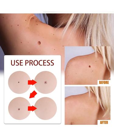 Stylo Anti Verrue Anti Taupe Stylo Pour Enlever Grain De Beaut Anti Cors Pieds Stylo Liquide D' limination Des Verrues Wart Removal Cream Cr me D' limination Instantan e des Verrues 2PC - Buy Online on GoSupps.com