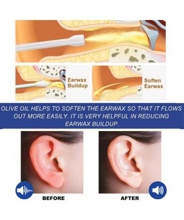 Tinnitus Relief Spray Tinnitus Relief for Ringing Ears Ear Tinnitus Sprays Ear Drops for Tinnitus Effective Herbal Drops for Tinnitus Blocked Ears Treatment Ear Noise Spray Ear Ringing Treatment Oil - Buy Online on GoSupps.com