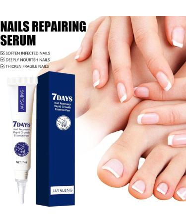 Flysmus 7 Days Nail Recovery Rapid Growth Essence Pen Natural 7 Days Nail Growth and Strengthening Serum Nail Growth & Strengthening Oil Serum for Thin Nails and Growth 20ml (2PCS) - Buy Online on GoSupps.com