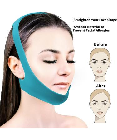 Babyfond Upgrade Anti Snore Chin Strap - Adjustable & Breathable Sleep Aid for Men Women - Stop Snoring CPAP Users - Larger Jaw Support Belt (Blue) - Buy Online on GoSupps.com