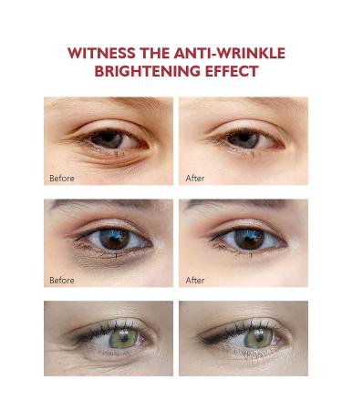 Retinol Eye Cream | Anti-Aging Moisturizer for Dark Circles Wrinkles & Puffiness - Shop Now! - Buy Online on GoSupps.com