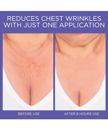 Chest Wrinkle Pads - Reusable Anti-Wrinkle Silicone Patches for Smooth Skin | Overnight Wrinkle Treatment - Buy Online on GoSupps.com