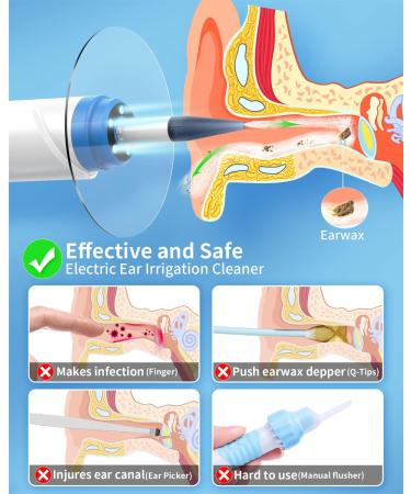 YUYUKO Electric Ear Wax Removal Kit - Ear Irrigation Cleaner with 4 Cleaning Modes and 10 Tips - Ear Flush Tool for Safe and Gentle Ear Cleaning - Buy Online on GoSupps.com