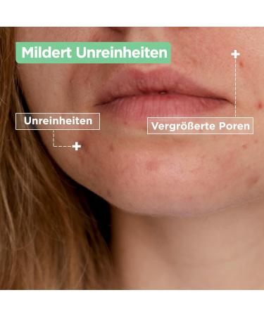  Mixa Mixa Anti-impurity mattifying gel cream with salicylic acid and AHA for oily skin prone to impurities 50ml - Buy Online on GoSupps.com