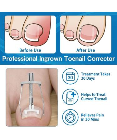 Ingrown Toenail Treatment Kit - 41 Pcs/Set with Professional Tools for Correcting Ingrown Toenails - Includes Corrector Patch, Strips, Podiatry Braces, and Nail Clipper - Buy Online on GoSupps.com