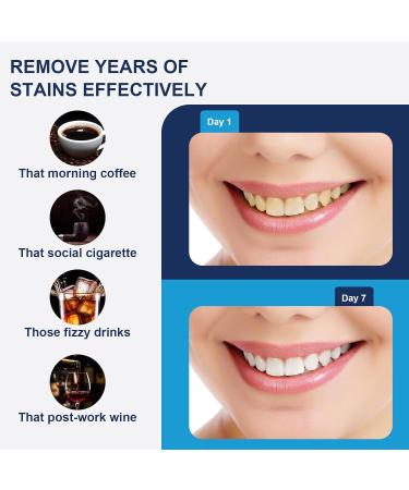 Teeth Whitening Kit Teeth Whitening Strips: 42 Strips 21 Treatments Teeth Whitening Kits Enamel Safe Non-Sensitive Formula - Buy Online on GoSupps.com