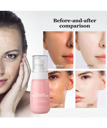 Watermelon Dew Drops Glow Recipe Niacinamide Dew Drops Serum Glow Recipe Watermelon Dew Drops Glow Recipe Watermelon Pore Minimizer And Priming Liquid Highlighter (2pc) - Buy Online on GoSupps.com