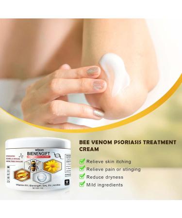 Buy Bee Venom Cream for Psoriasis & Warts - Natural Soothing Treatment Worldwide Shipping - Buy Online on GoSupps.com