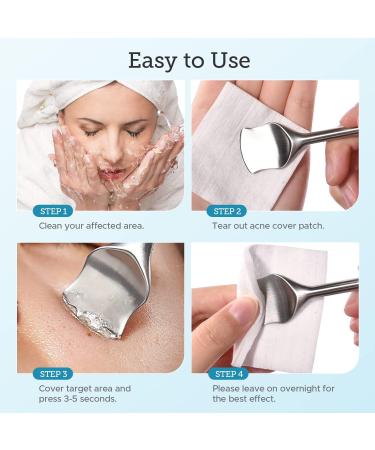 LitBear Pore Prep Tool | Blackhead Remover & Pimple Popper Kit | Stainless Steel Extraction Tool for Acne, Whitehead, Blemish & Comedone - Buy Online on GoSupps.com