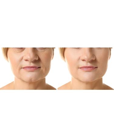 Vitamin E Oil 100% Pure - 75 000 IU Full Spectrum Alpha Tocopherol - Hydrating Skin Hair & Nails - 4 oz - Buy Online on GoSupps.com