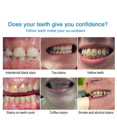 LANTHOME Teeth Whitening Kit: Herbaluxy Essence & Pen with Purely White Deluxe Formula - Nutty Buzzy Teeth Whitening Set - Buy Online on GoSupps.com