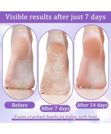 4 Paires Masque Pied Exfoliant Masque Pieds Peeling Exfoliant De Lavande Foot Peel Mask Hydratant Et Nourrir Simple Utiliser Soin Des Pieds Pour Peaux S ches Et Ab m es Hommes Et Femmes - Buy Online on GoSupps.com