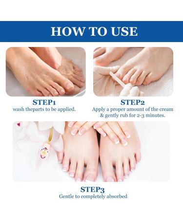 Cr me de Soin des Ongles Emollient Ongle Soin-Ongles Des Pieds Nourrissant et Renforce pour Ongles R paration D ongle Pour Les Ongle D color s paissis miett s Cass s 20g - Buy Online on GoSupps.com