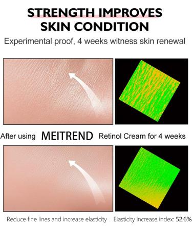 Retinol Cream - Face Cream Anti-Aging Wrinkle Night/Day Cream With 2.5% Retinol - Eye Face Moisturiser to Help Skin Regenerating Reduce Wrinkles Fine Lines Dry Skin Age Spots 30ml Retinol Face Cream - Buy Online on GoSupps.com