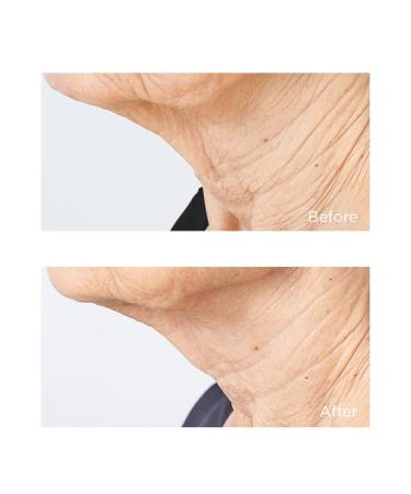 Cold Plasma Plus + Sub/D Chin & Neck | Revitalize & Tighten Skin | International Shipping Available - Buy Online on GoSupps.com