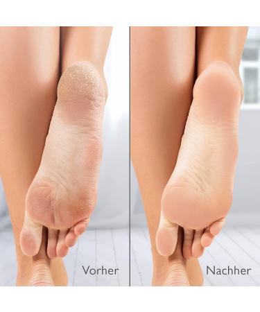 Silk'n VacuPedi Filters - 4-Pack for Dead Skin Flakes, Compatible with Silk'n VacuPedi - Buy Online on GoSupps.com