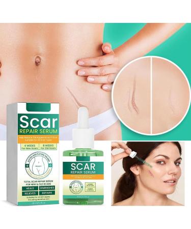 Liascy ScarRevita Advanced Repair Serum - For All Types of Scars (2pcs) - Buy Online on GoSupps.com