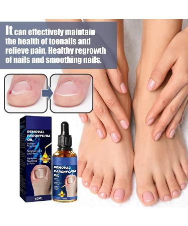German Toenailcare Removal Paronychia Oil - Nail Renewal Liquid for Damaged Nails - Toenail Treatment Oil for Repair and Improve Toenail Health (2pcs) - Buy Online on GoSupps.com