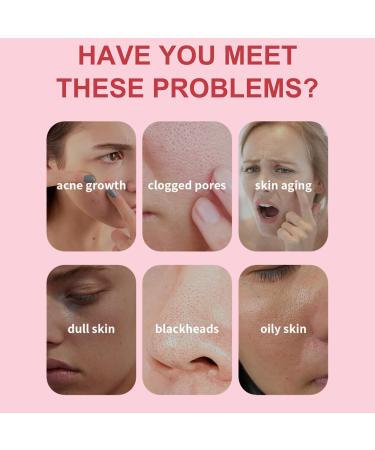 Tomato Clay Face Mask Clay Mask for Pores Moisturizing Clay Mask Controlling Oil Mud Mask for Deep Cleansing Exfoliating Facial Mask Remove Acne & Refining Pores Reduce Blackheads & Dark Spots - Buy Online on GoSupps.com